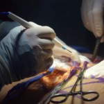 Plastic surgery Benefits